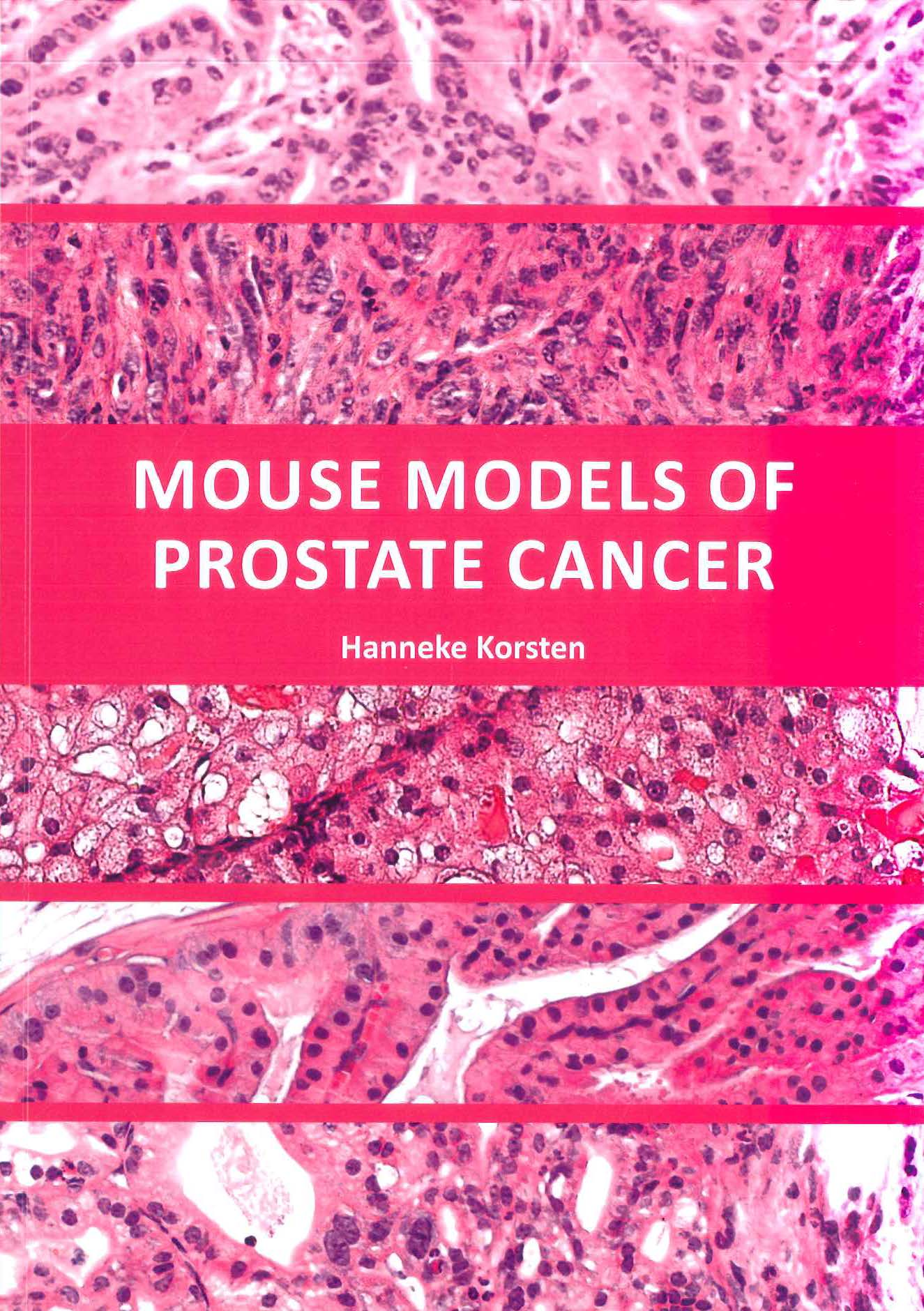 RePub, Erasmus University Repository: Mouse Models Of Prostate Cancer